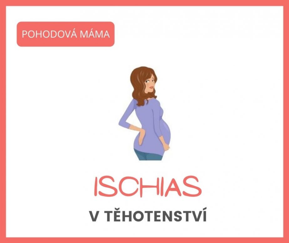 ischias v těhotenství