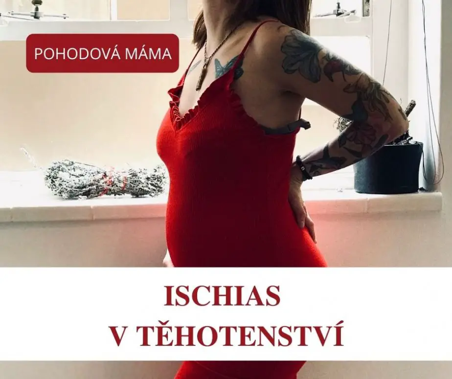 ischias v těhotenství