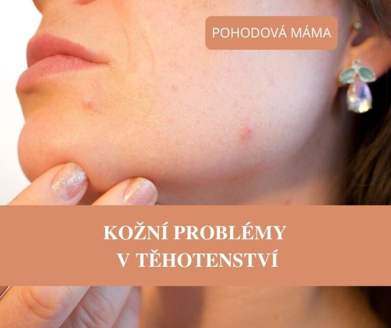 Kožní problémy v těhotenství: suchá kůže, pigmentové skvrny, akné, strie, křečové žíly